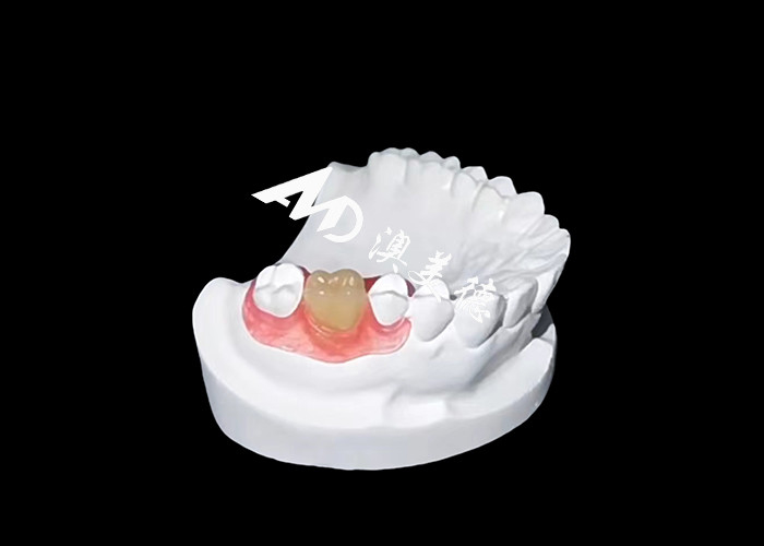 Nesbite flexible dentures offer a seamless solution for a comfortable and natural-looking smile