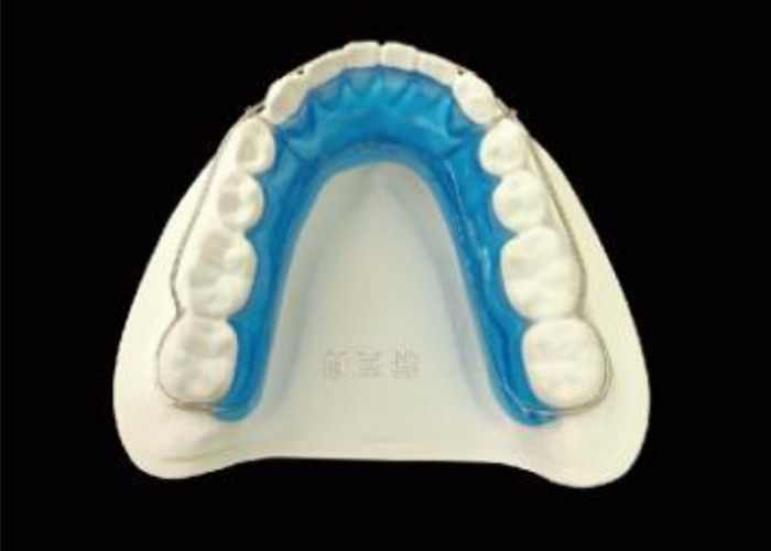 Maintain Your Smile with Begg Retainer for Perfect Alignment and Long-Lasting Results