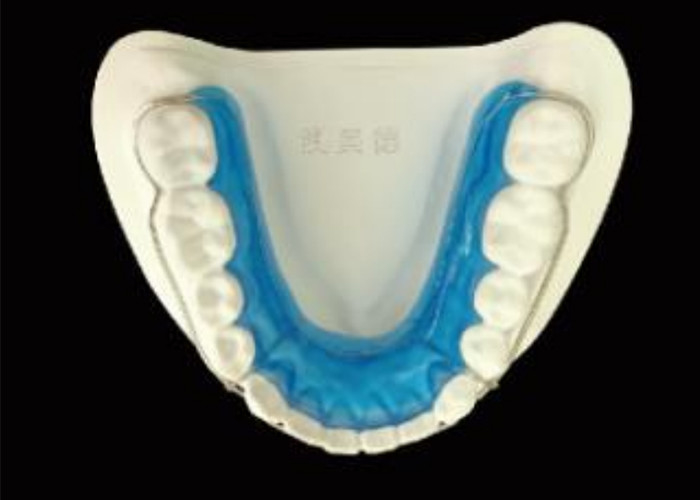 Maintain Your Smile with Begg Retainer for Perfect Alignment and Long-Lasting Results