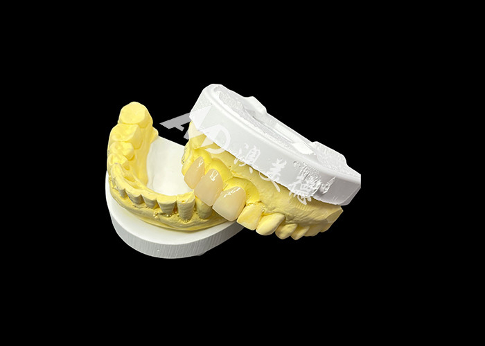 Upgrade Your Dental Aesthetics with a Ceramic Crown Bridge that Combines Exceptional Aesthetics and Outstanding Biocompatibility for a Natural, Comfortable Smile