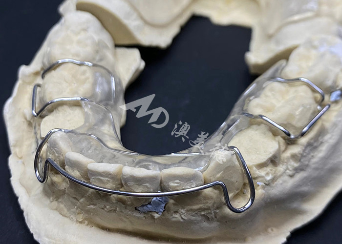 Comfortable To Wear AMD Dental Lab's Hawley Retainer For Safe And Healthy Orthodontics