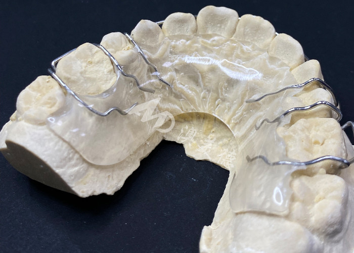 Hawley retainer Orthodontic Appliances for Comfortable Teeth Alignment Correction