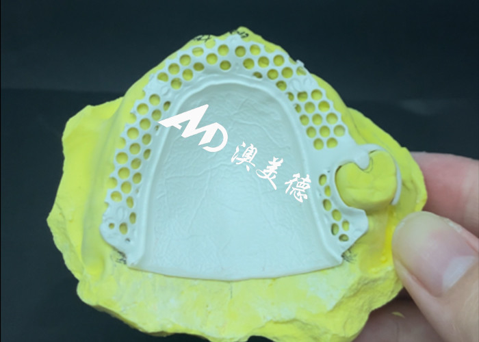 Removable Dentures HPP framework Custom Fit for Optimal Function Comfort and Aesthetics