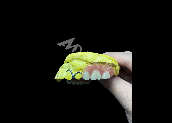 Adjustable Cast Partial Dentures for Enhanced Comfort and Stability, Perfect for Chewing and Speaking Needs