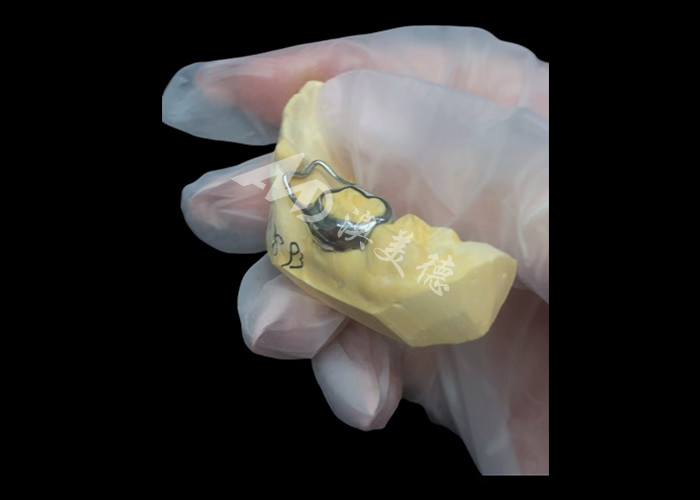 Orthodontic Space maintainer an invaluable device ingeniously guarding children's tooth gaps ensuring proper tooth development.