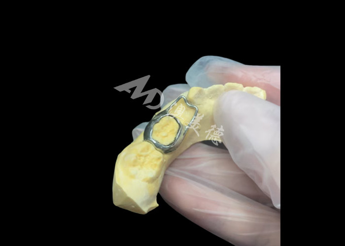 Orthodontic Space maintainer an invaluable device ingeniously guarding children's tooth gaps ensuring proper tooth development.