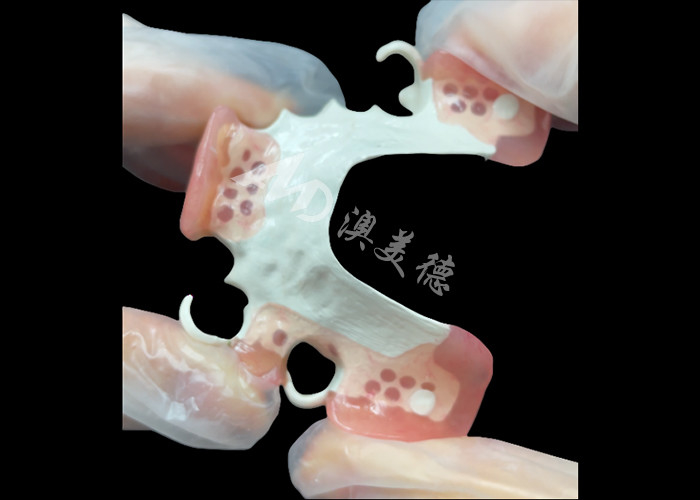 Aesthetic Custom made Removable Partial Denture HPP Framework for Natural Partial Tooth Replacement