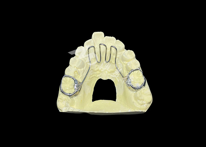Tongue Cribs Orthodontic Appliance Used To Address Tongue Thrust Issues And Aid In Proper Dental Alignment