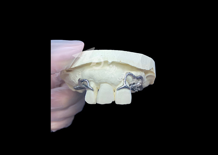 Easy Fit Custom Cast Partial Denture Stable and Natural-looking Framework for Fast Results