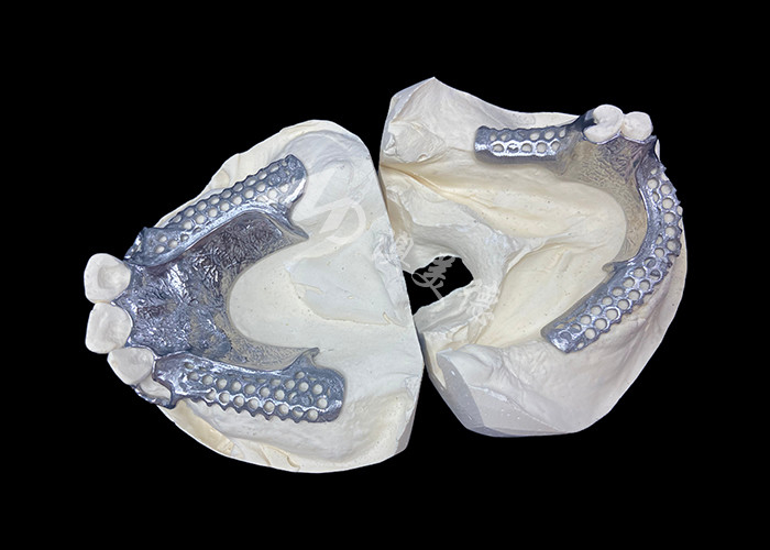 Easy Fit Custom Cast Partial Denture Stable and Natural-looking Framework for Fast Results