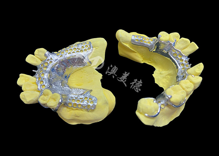 Custom Cast Partial Denture Natural Looking Solution For Enhanced Comfort And Speech