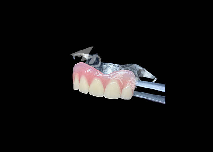 Long Lasting Cast Partial Dentures Easy Maintenance for Improved Chewing and Perfect Smile