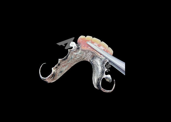 Long Lasting Cast Partial Dentures Easy Maintenance for Improved Chewing and Perfect Smile