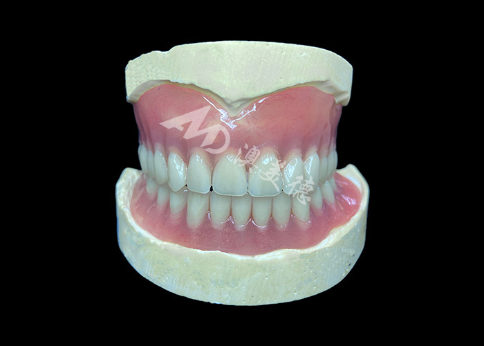 Easy-to-Clean Custom Cast Partial Dentures Ideal for Restoring Chewing Ability and Smiles