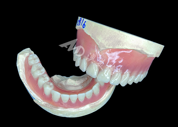 Easy-to-Clean Custom Cast Partial Dentures Ideal for Restoring Chewing Ability and Smiles