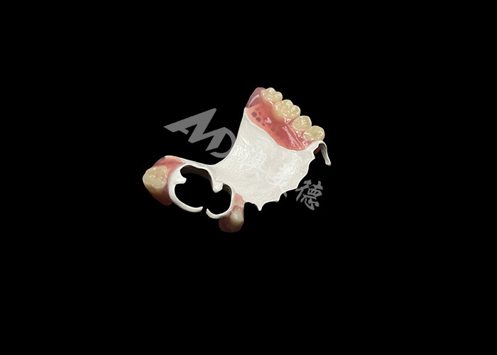 High Quality Comfortable Partial Denture With HPP Framework Restores Chewing And Speaking Ability