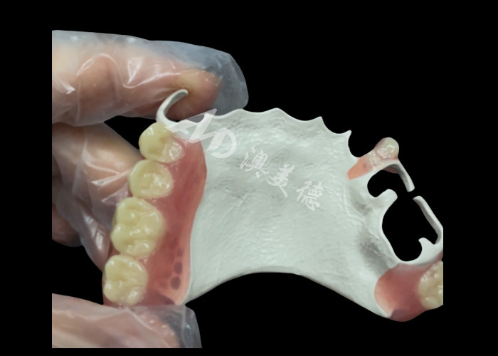 High Quality Comfortable Partial Denture With HPP Framework Restores Chewing And Speaking Ability