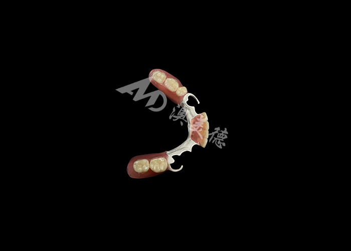 Custom Made Durable Cast Partial Dentures With Hpp Framework For Restoring Your Smile