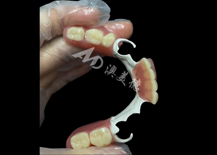 Custom Made Durable Cast Partial Dentures With Hpp Framework For Restoring Your Smile