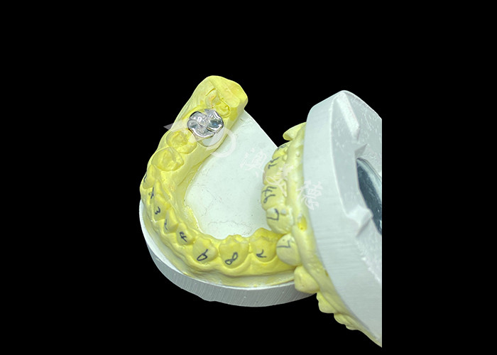 Long-lasting Function Durable Full Metal Cast Crown for Superior Tooth Restoration