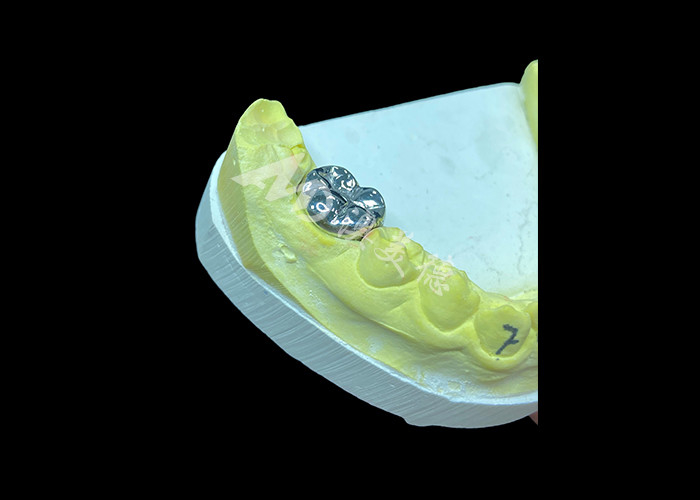 Long-lasting Function Durable Full Metal Cast Crown for Superior Tooth Restoration