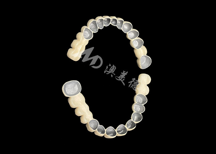 Customized Porcelain Fused To Metal Dental Crown Bridge For Natural Smile Enhancement