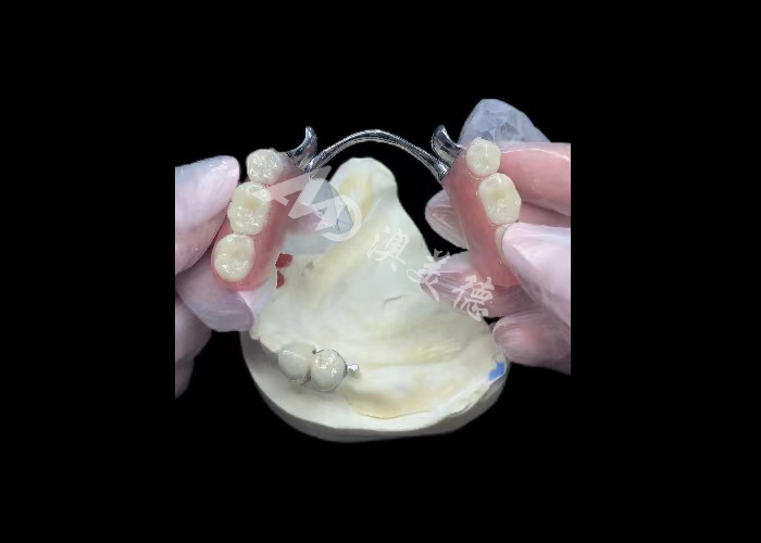 Durable Porcelain Fused To Metal Dental Crown PFM Crown For Restoration
