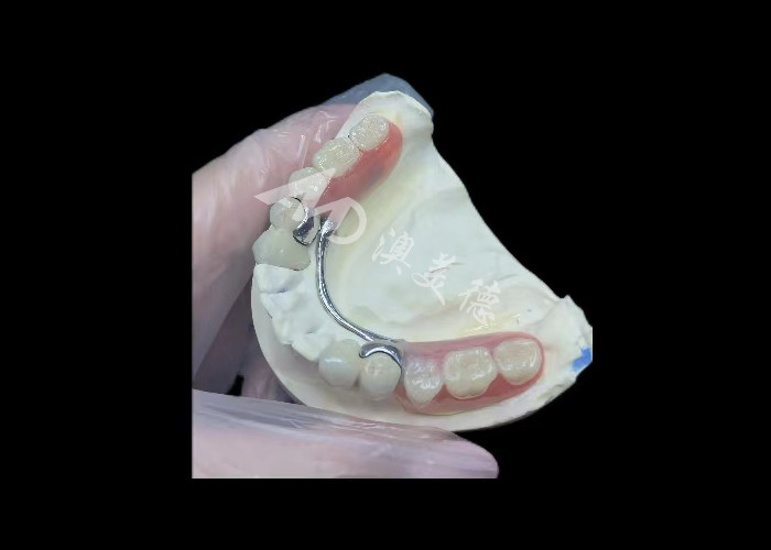Durable Porcelain Fused To Metal Dental Crown PFM Crown For Restoration