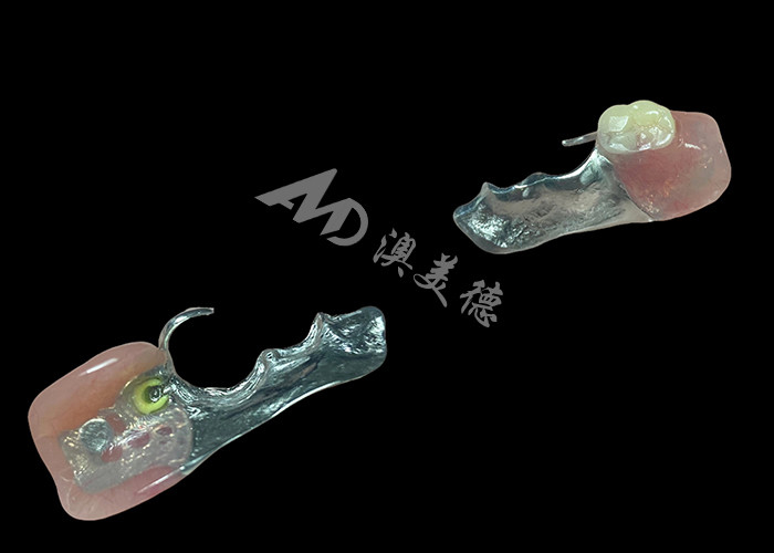 Customized Cast Partial Dentures Precision Metal Framework For Optimal Fit And Functionality