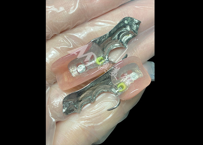 Customized Cast Partial Dentures Precision Metal Framework For Optimal Fit And Functionality
