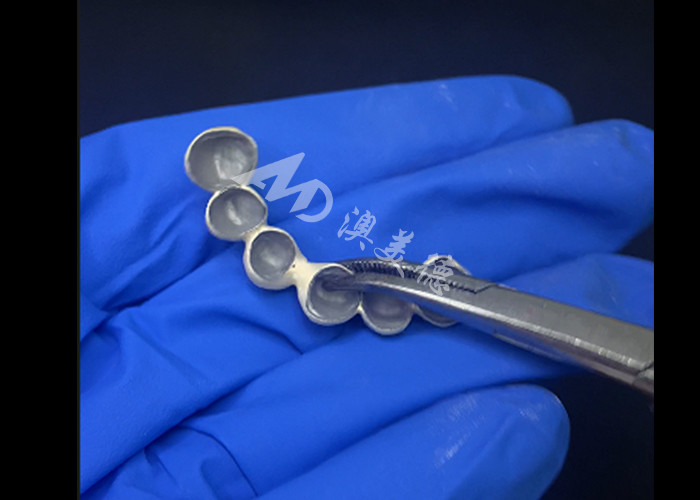 Biocompatible Porcelain Fused To Metal Crown High Durability For Enhanced Restoration