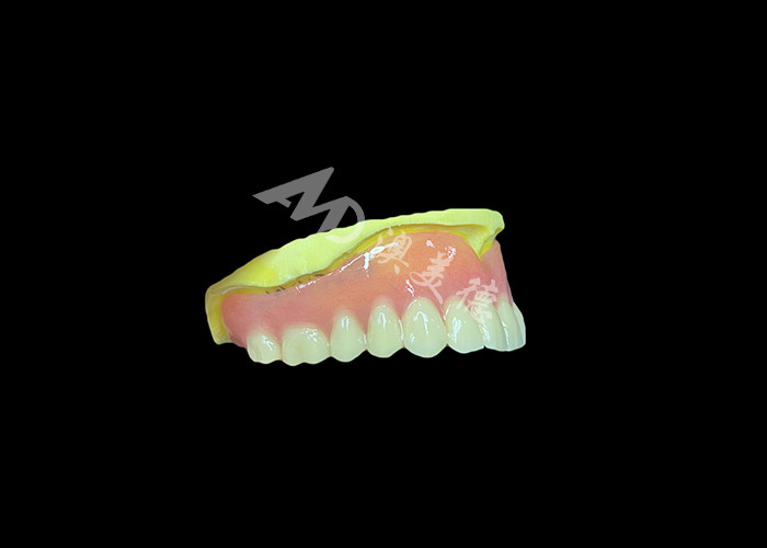 Cast Partial Dentures Crafted for Durability Comfort and Aesthetic and Lasts Longer