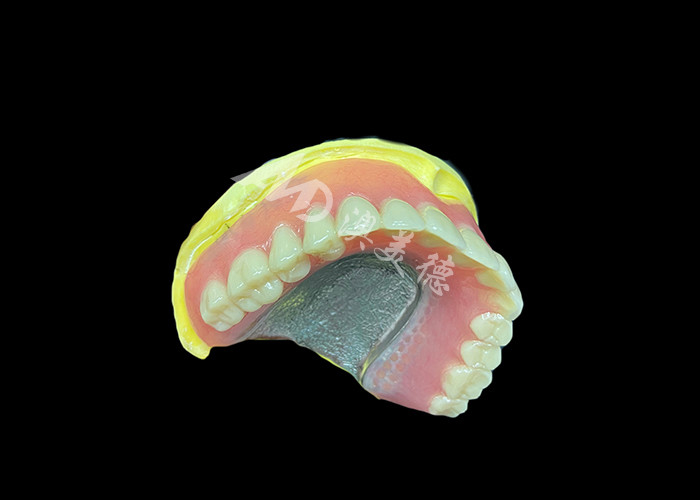 Cast Partial Dentures Crafted for Durability Comfort and Aesthetic and Lasts Longer