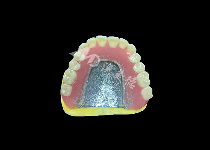 Cast Partial Dentures Crafted for Durability Comfort and Aesthetic and Lasts Longer