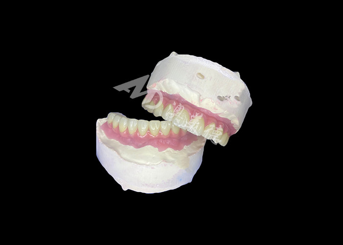 Dental All-on-6 Dental Implant Supported Dentures With Stability And Comfort