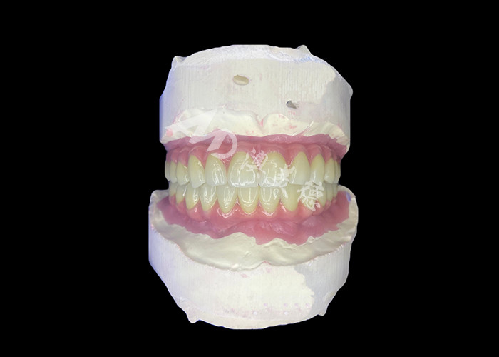 Dental All-on-6 Dental Implant Supported Dentures With Stability And Comfort
