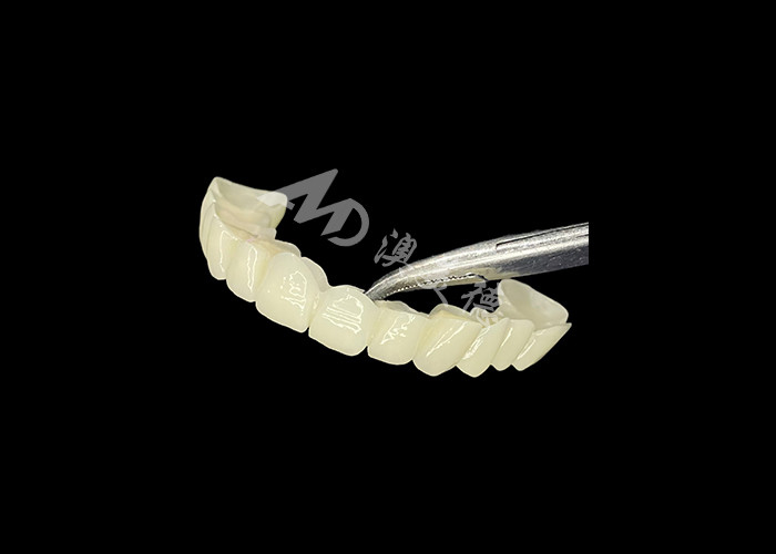 High Translucency Zirconia Dental Bridge Strong and Natural Looking for Seamless Smile Restoration