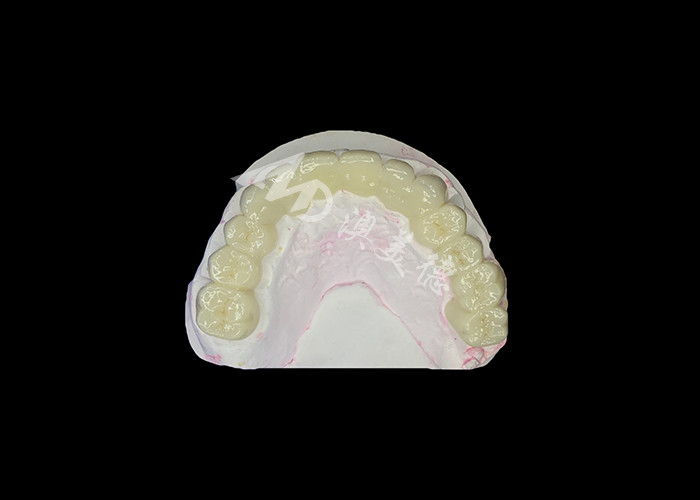 High Translucency Zirconia Dental Bridge Strong and Natural Looking for Seamless Smile Restoration