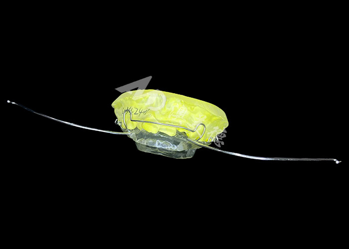 Aesthetic Orthodontic Appliance Modified Activator Durable Material for Effective Jaw Alignment