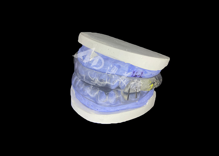 Shark Anti-Snoring Device Adjustable Mandibular Advancement Device For Improved Snoring Relief And Sleep Enhancement