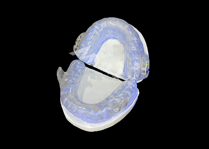 Shark Anti-Snoring Device Adjustable Mandibular Advancement Device For Improved Snoring Relief And Sleep Enhancement