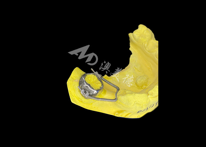 Sliding Loop Regainer for Effective Space Recovery and Precise Tooth Movement to Achieve Optimal Alignment in Orthodontic Treatments