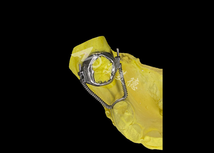 Sliding Loop Regainer for Effective Space Recovery and Precise Tooth Movement to Achieve Optimal Alignment in Orthodontic Treatments