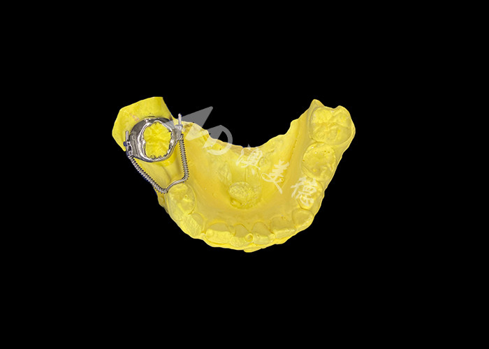 Sliding Loop Regainer for Effective Space Recovery and Precise Tooth Movement to Achieve Optimal Alignment in Orthodontic Treatments