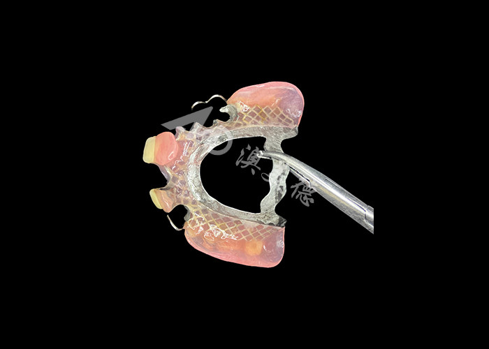 Customizable Fit Cast Partial Dentures for Precision Durability and Comfort in Partial Tooth Replacement