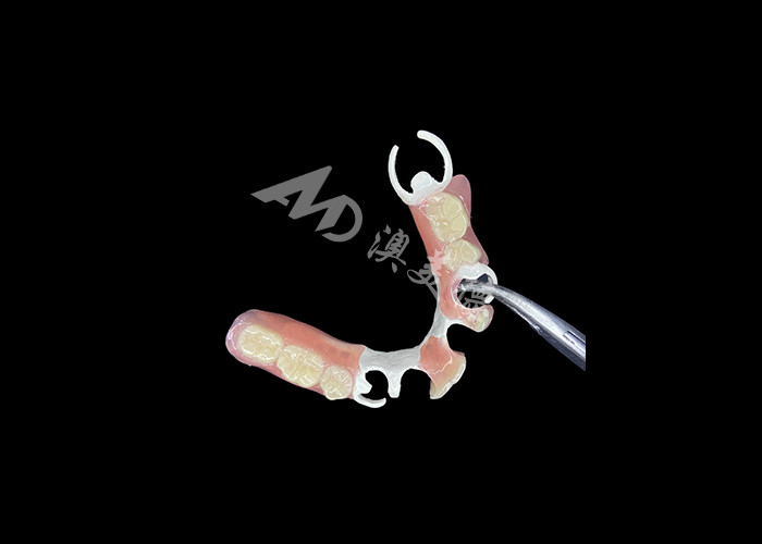 Lightweight and Durable HPP Framework Partial Dentures The Perfect Blend of Strength and Comfort
