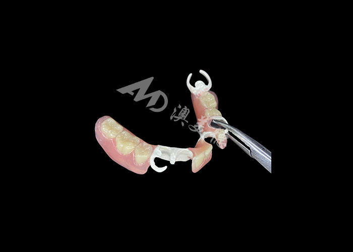 Lightweight and Durable HPP Framework Partial Dentures The Perfect Blend of Strength and Comfort