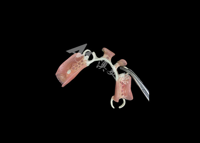 Lightweight and Durable HPP Framework Partial Dentures The Perfect Blend of Strength and Comfort