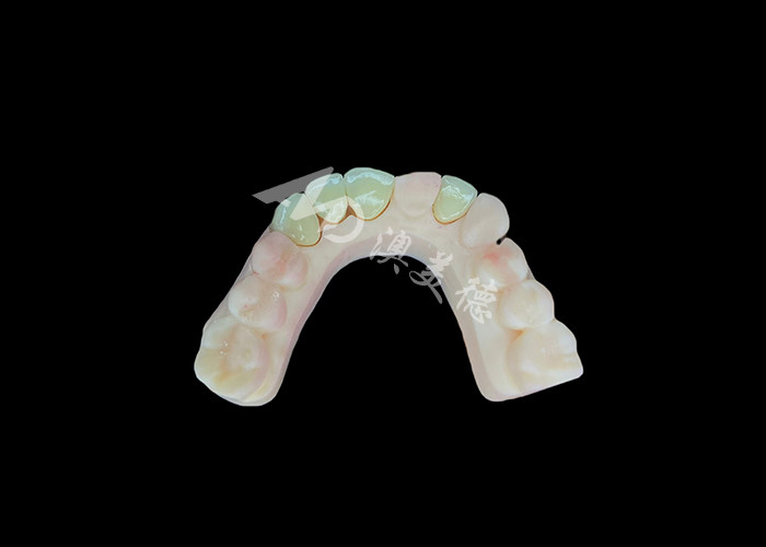 Natural and Comfortable Fit Zirconia Porcelain Crown China Dental Lab Customizable Shade
