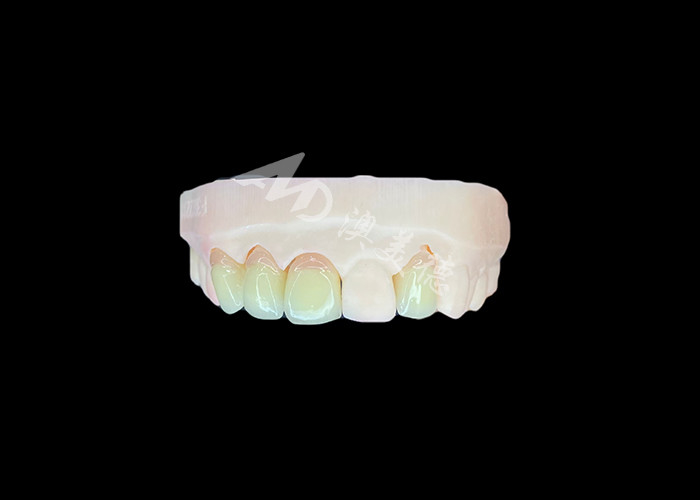 Natural and Comfortable Fit Zirconia Porcelain Crown China Dental Lab Customizable Shade